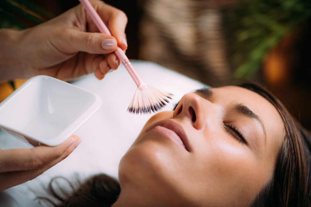 foto-peeling-químico-tratamiento-facial-estetica-y-belleza-raquel